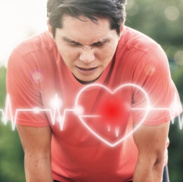 What Are The Arrhythmias That Can Occur While You Exercise
