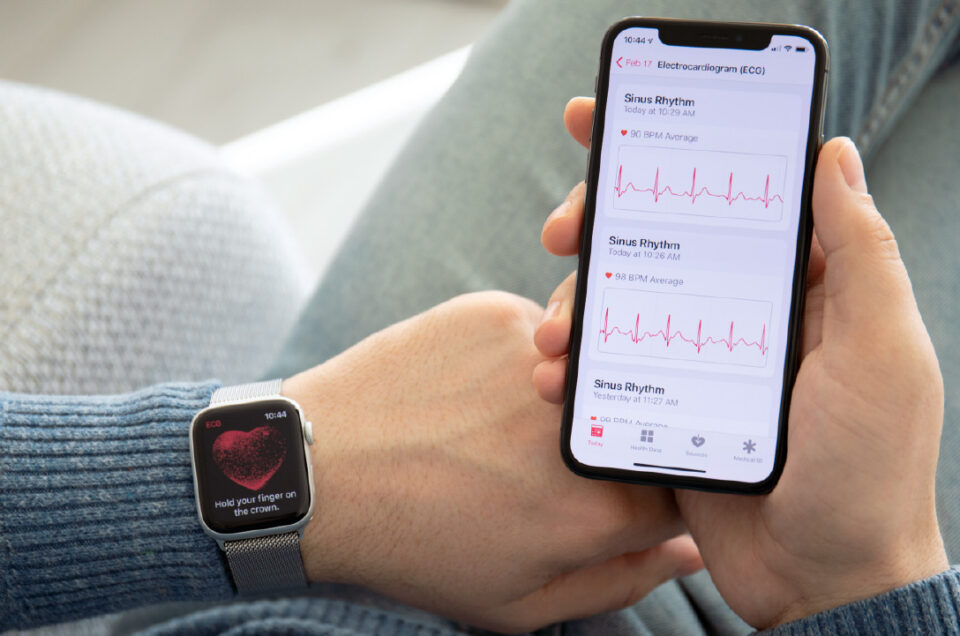 Wearable Technology, now with ECG – Apple Watch Series 7 vs Frontier X2