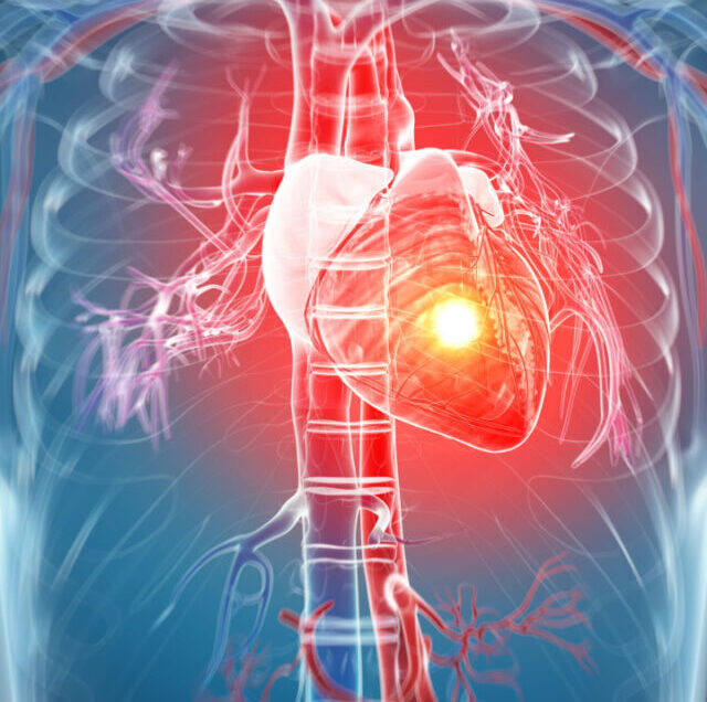 Shutterstock_128572196