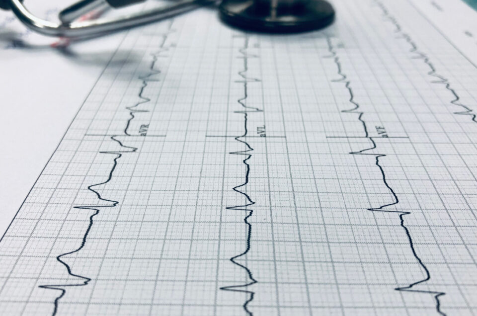 Preventing Complications from AFib