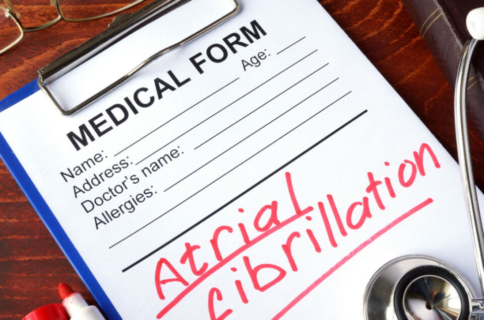 Preventing AFib Naturally: Proven Tips for Heart Health