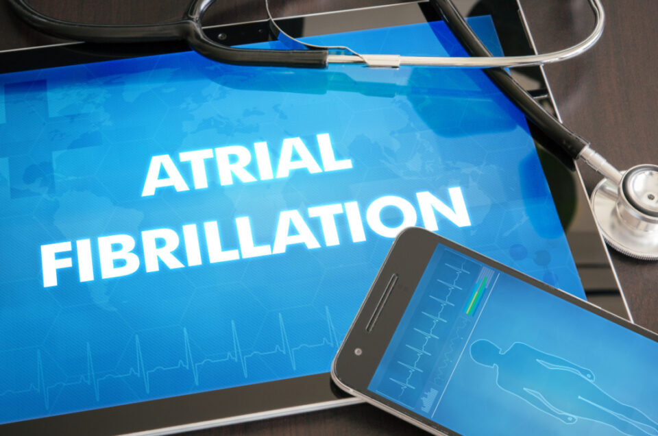 Paroxysmal Atrial Fibrillation What Are the Causes, Symptoms, and Treatment Options for Paroxysmal AFib