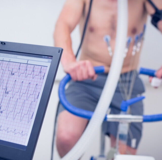 What is the purpose and procedure of a heart stress test