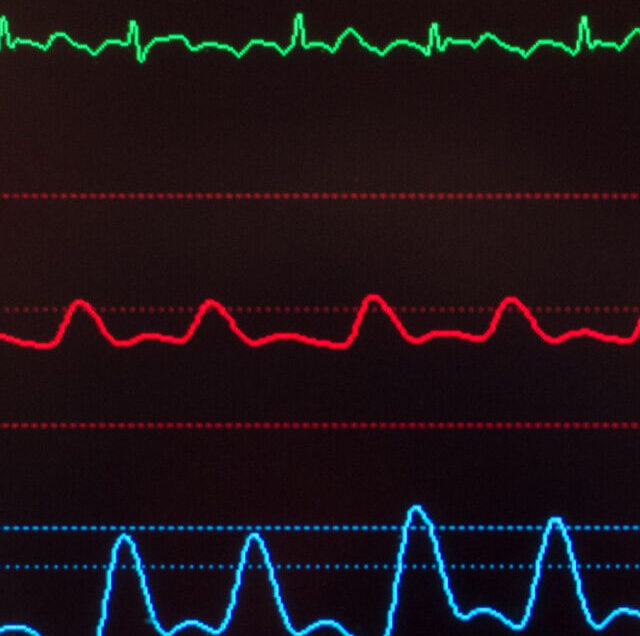 Shutterstock_532893256