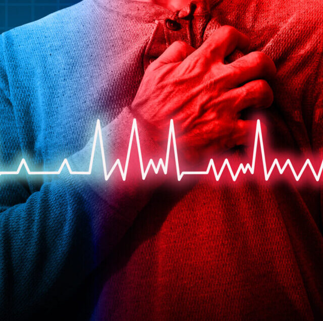 Heart,Disorder,And,Atrial,Fibrillation,Ecg,As,A,Coronary,Cardiac