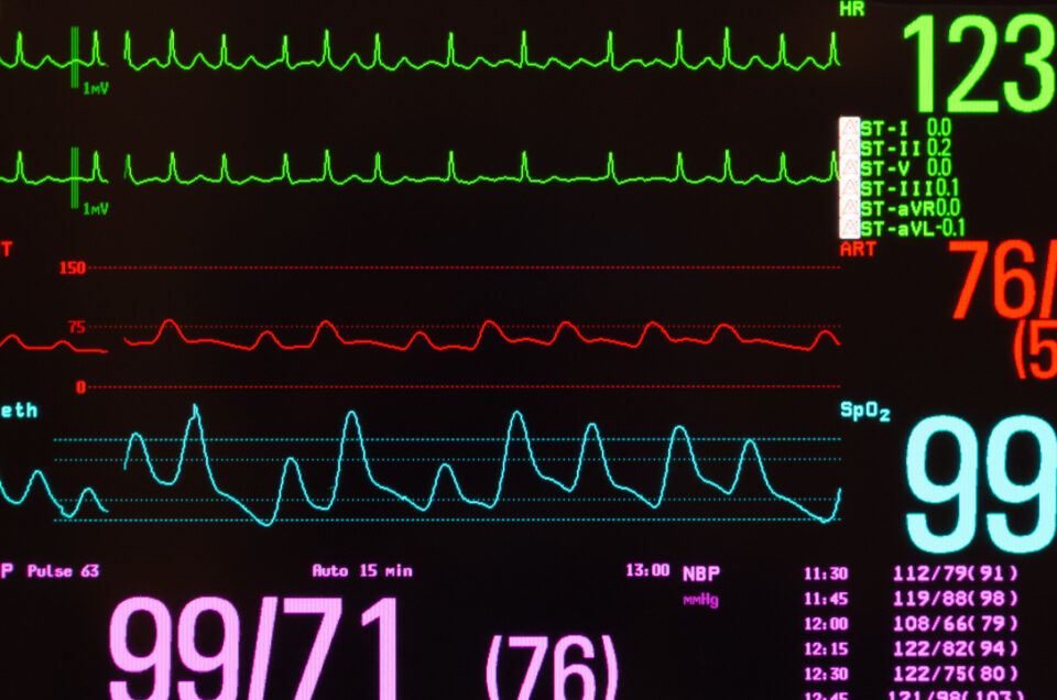 Heart Rate Variability Measurement