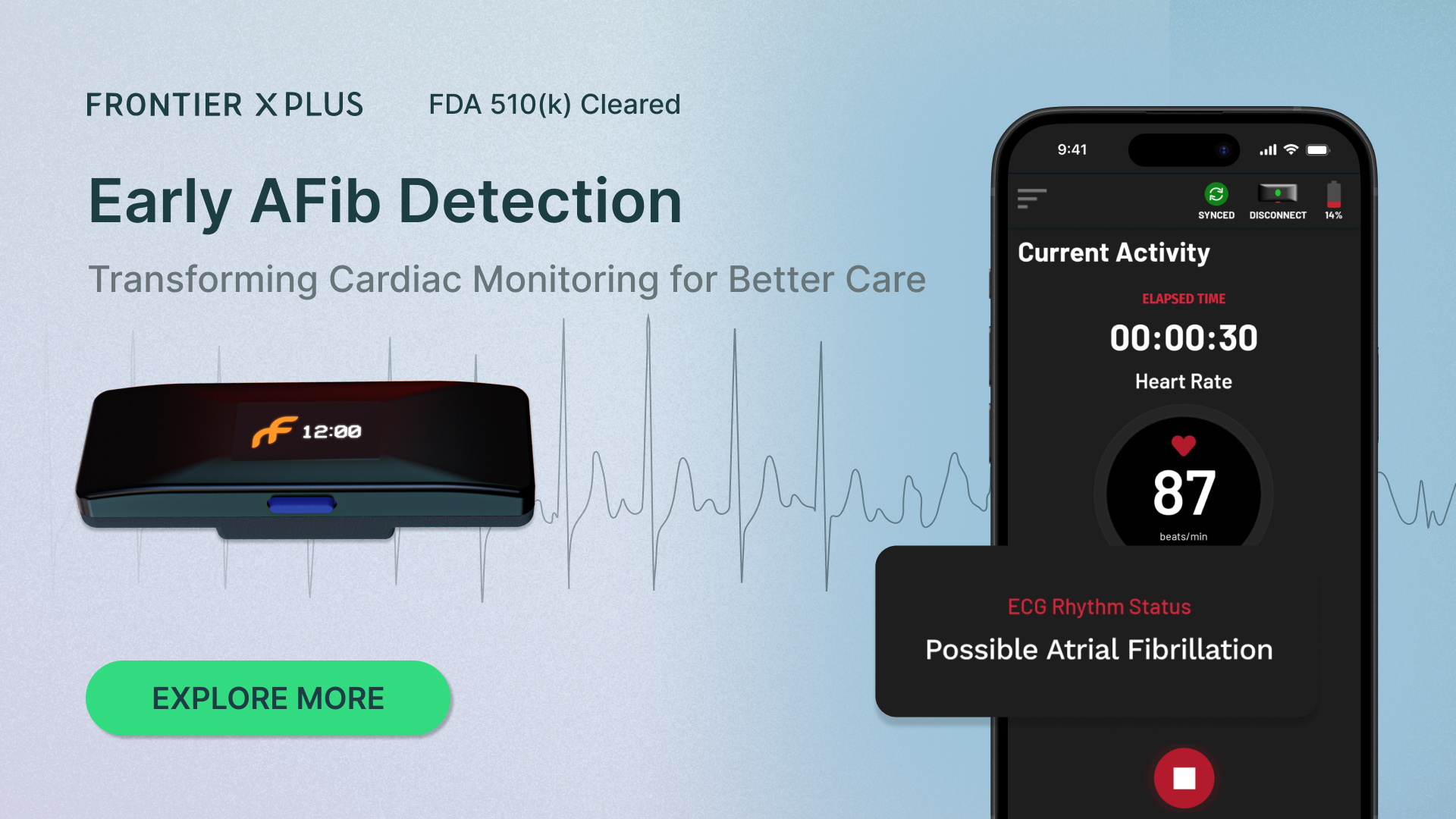 early AF detection with Frontier X Plus