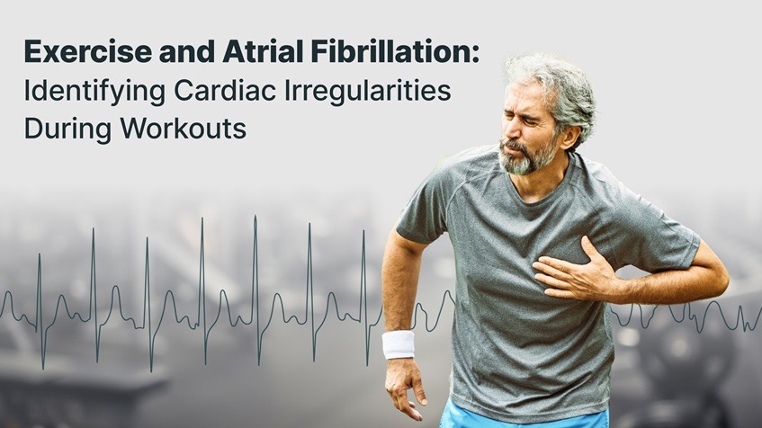 Exercise and Atrial Fibrillation: Identifying Cardiac Irregularities During Workouts