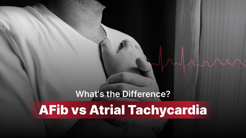 Atrial Tachycardia vs AFib: What’s the Difference?
